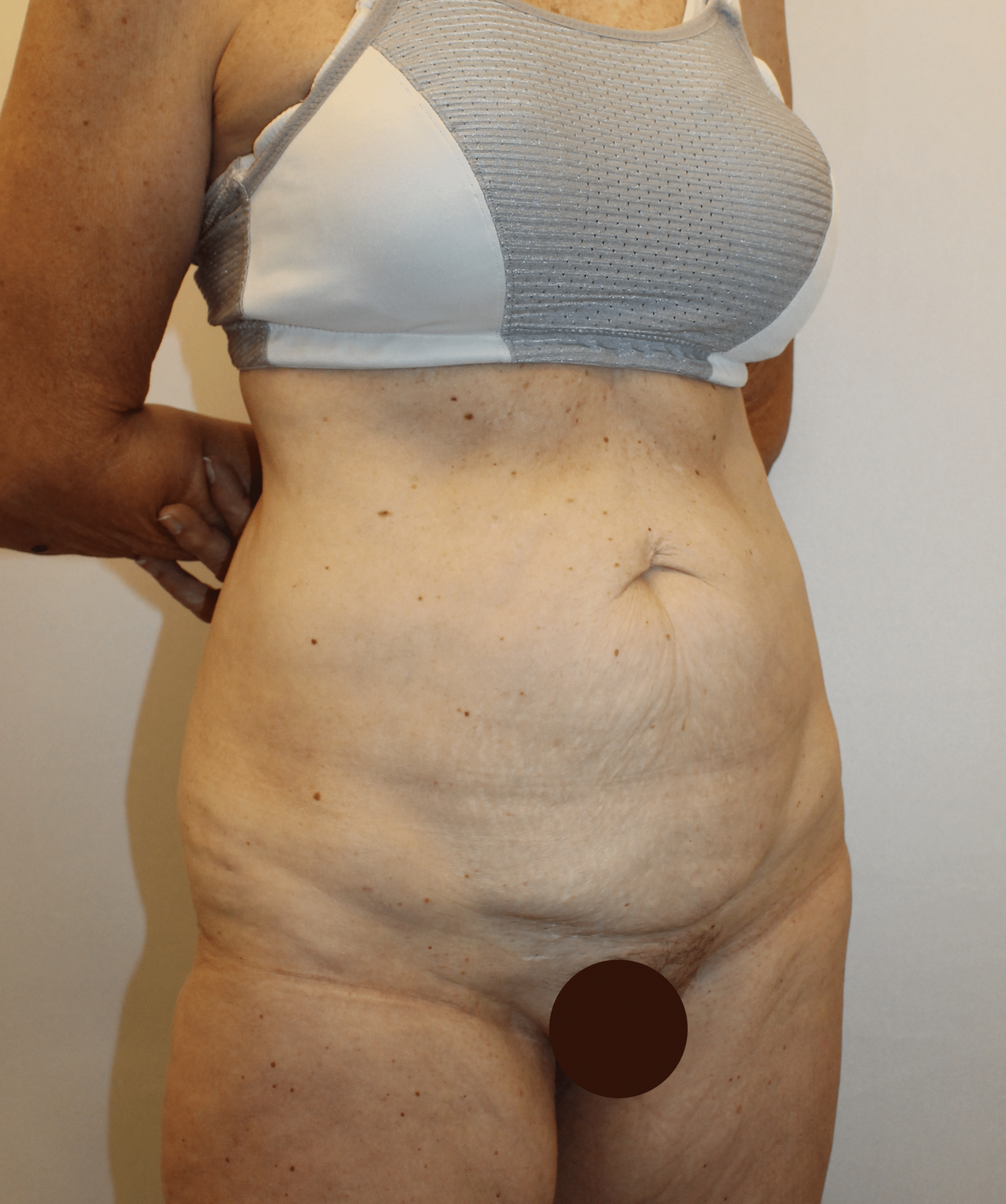 Before Image:  - right-front-oblique