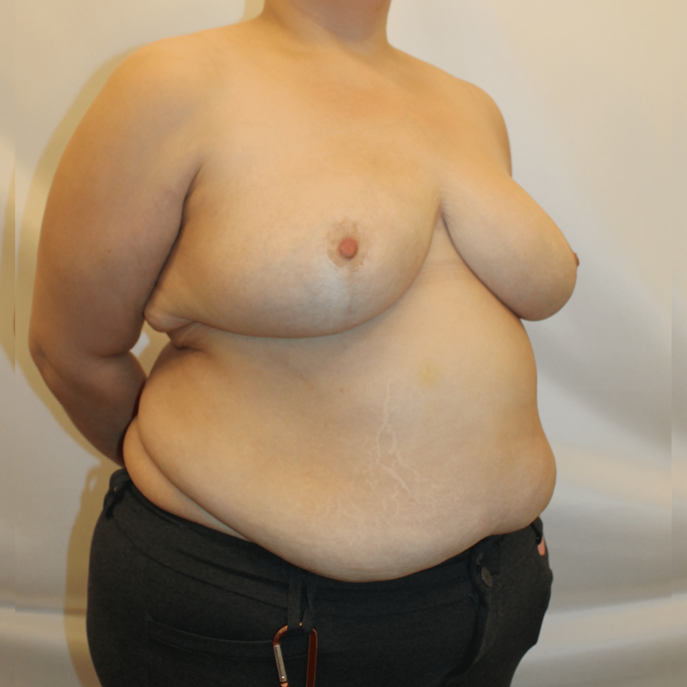 After Image:  - right-front-oblique