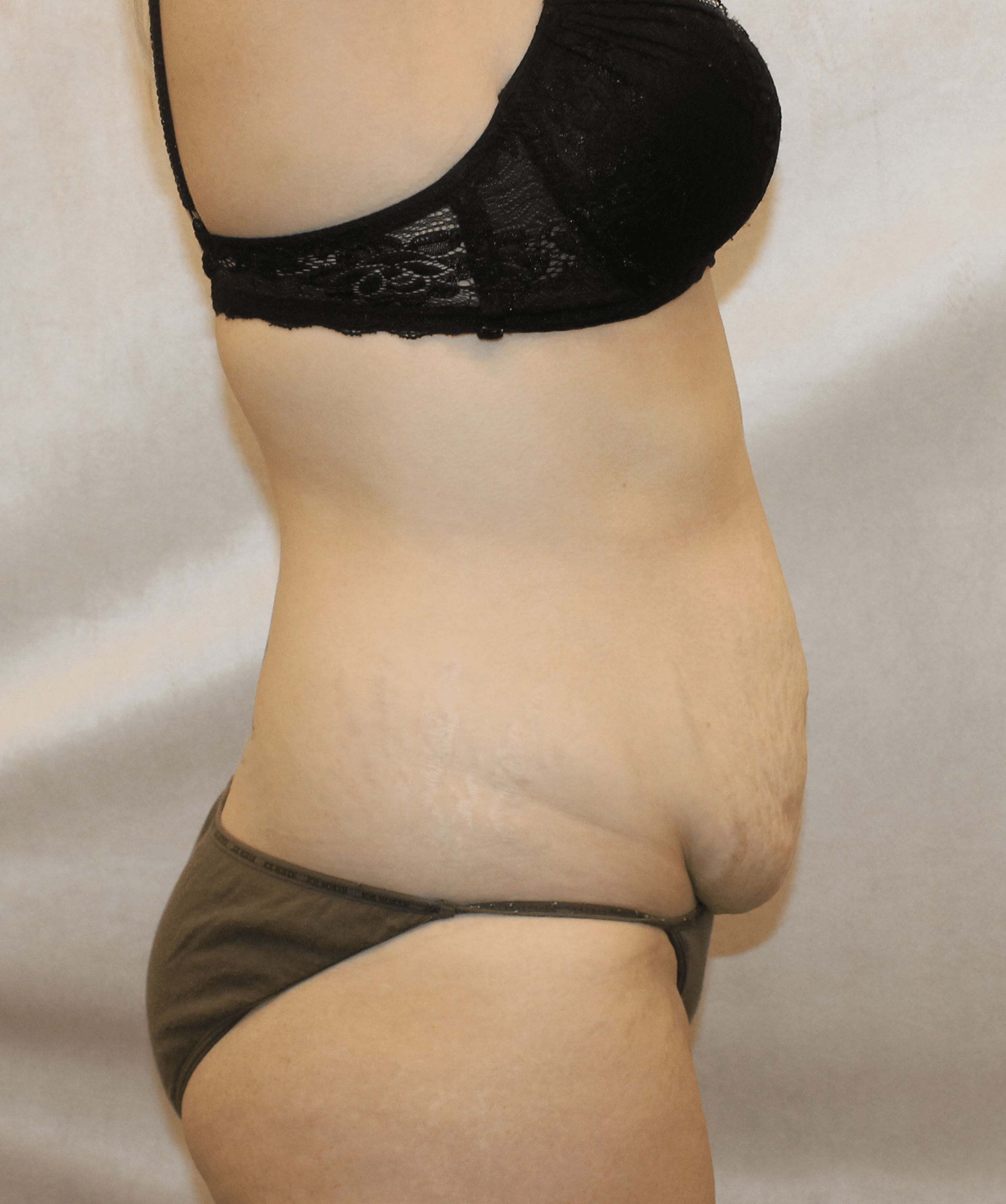 Before Image:  - right-side