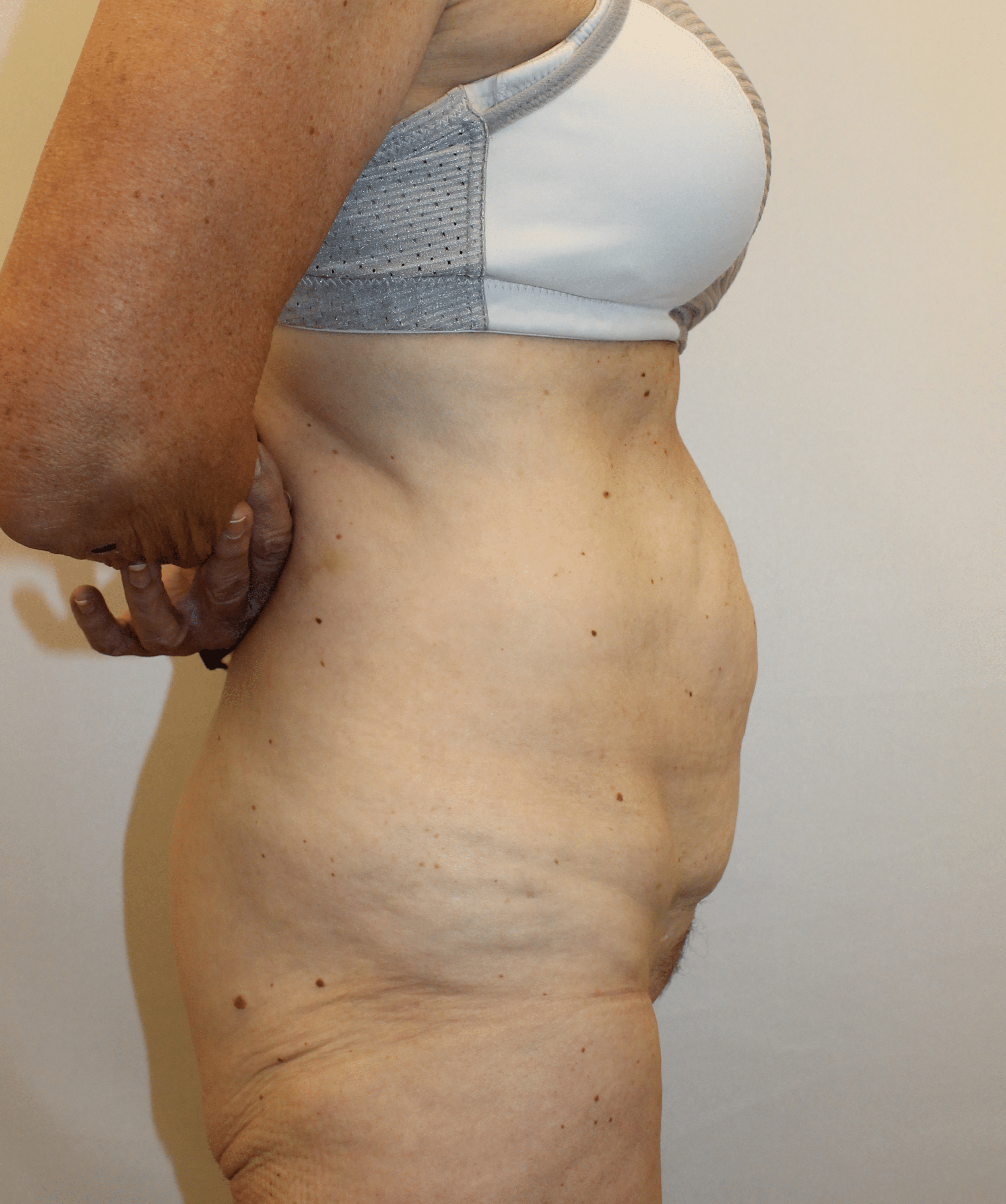 Before Image:  - right-side