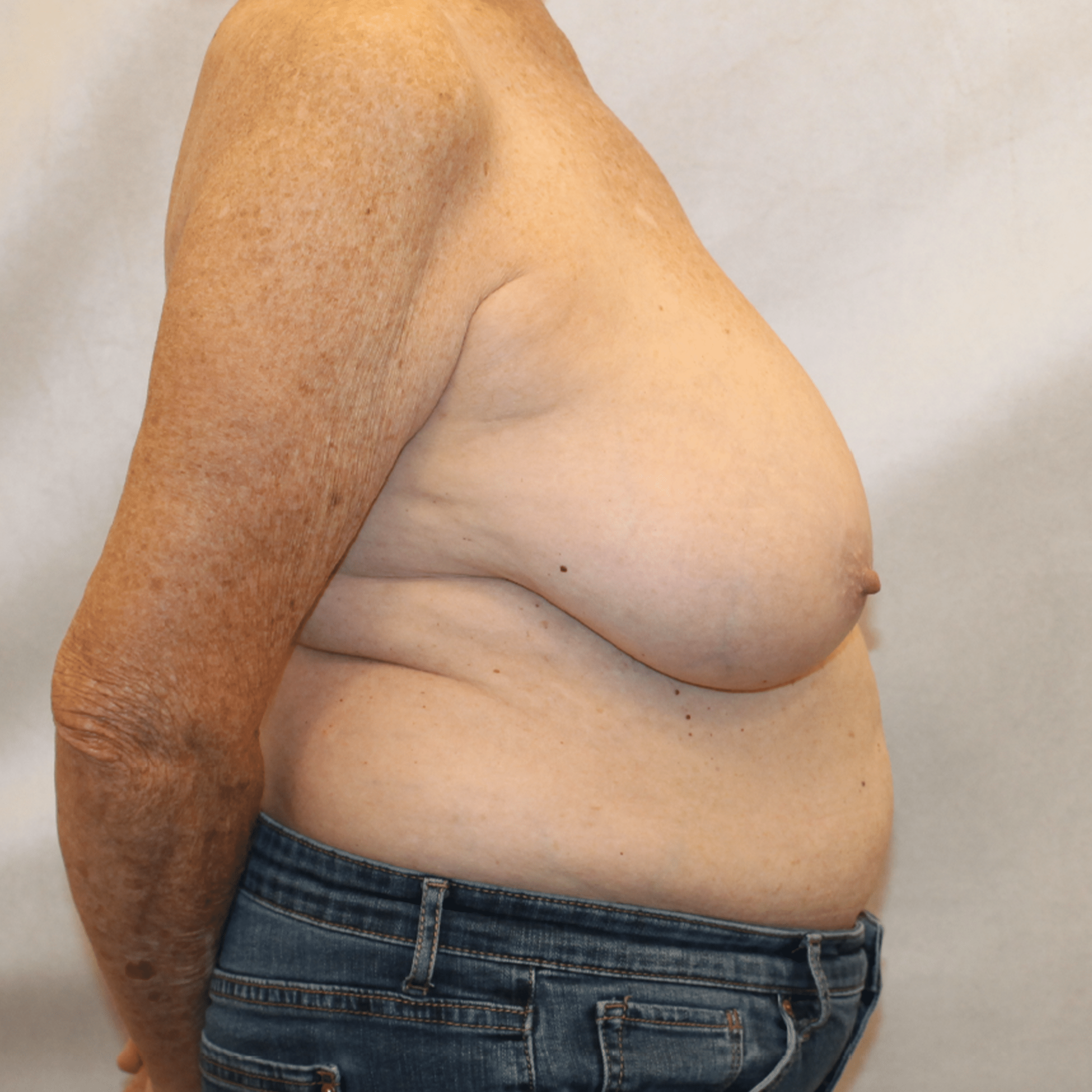 Before Image:  - right-side