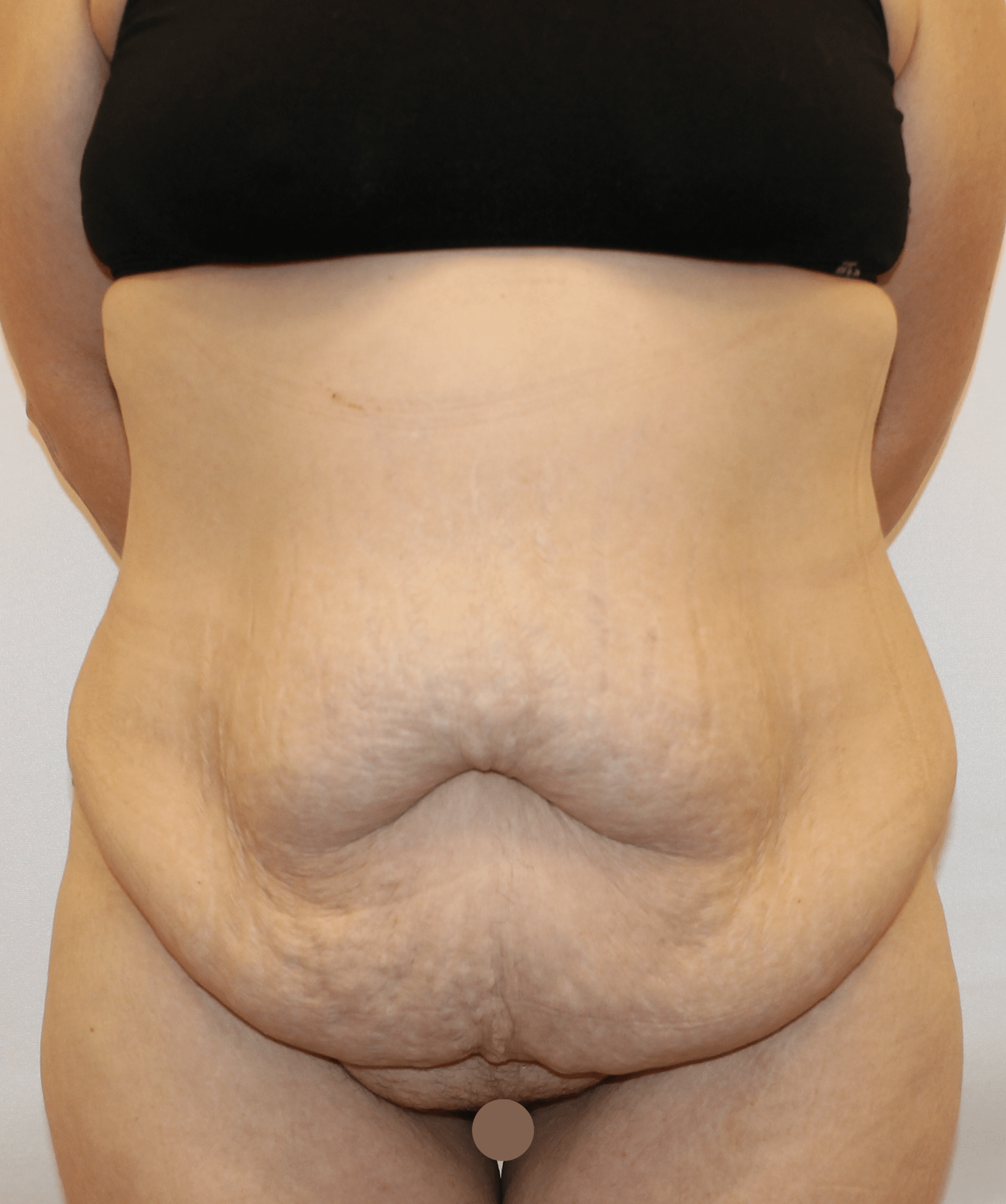 Before Image:  - front