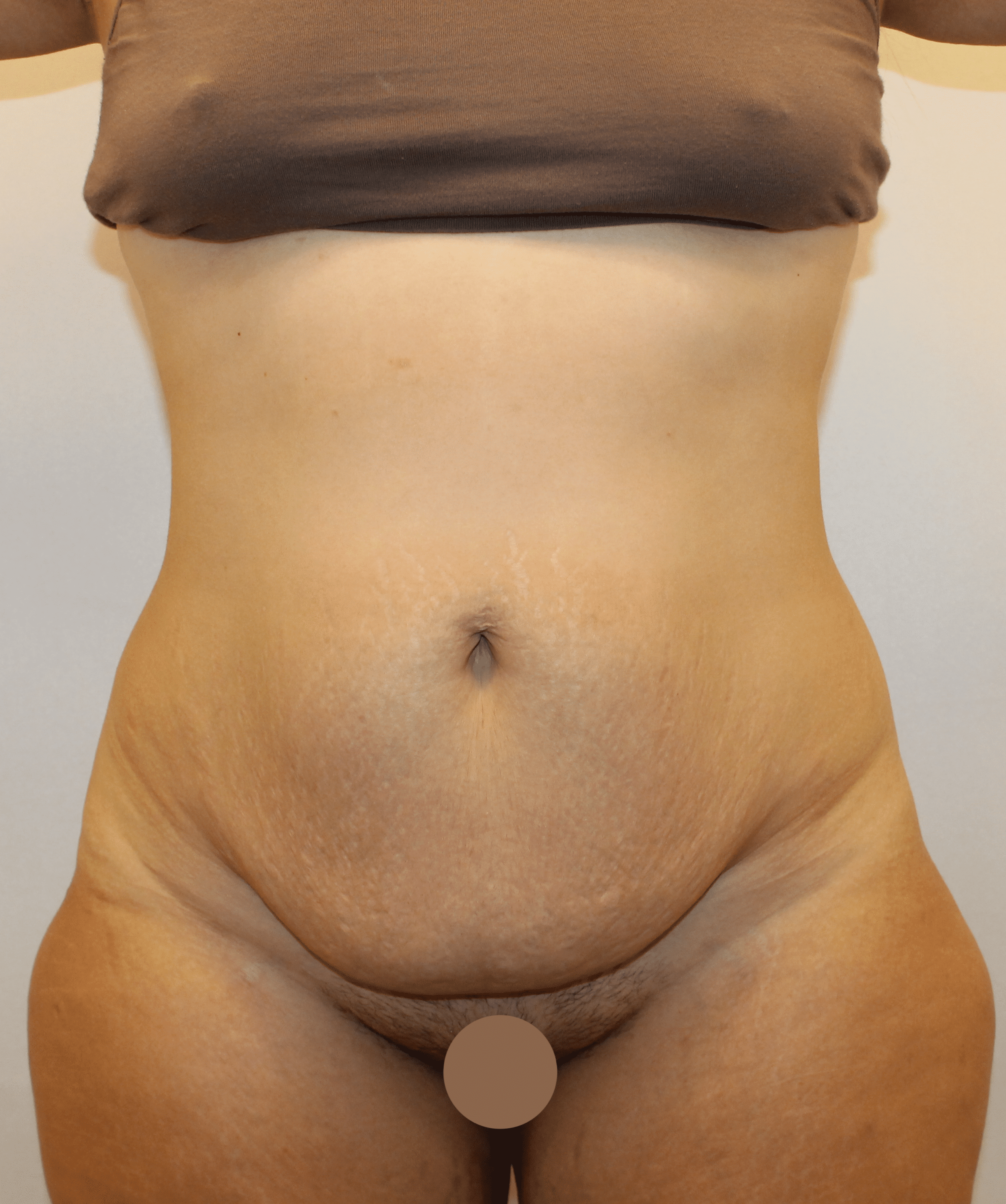 Before Image:  - front