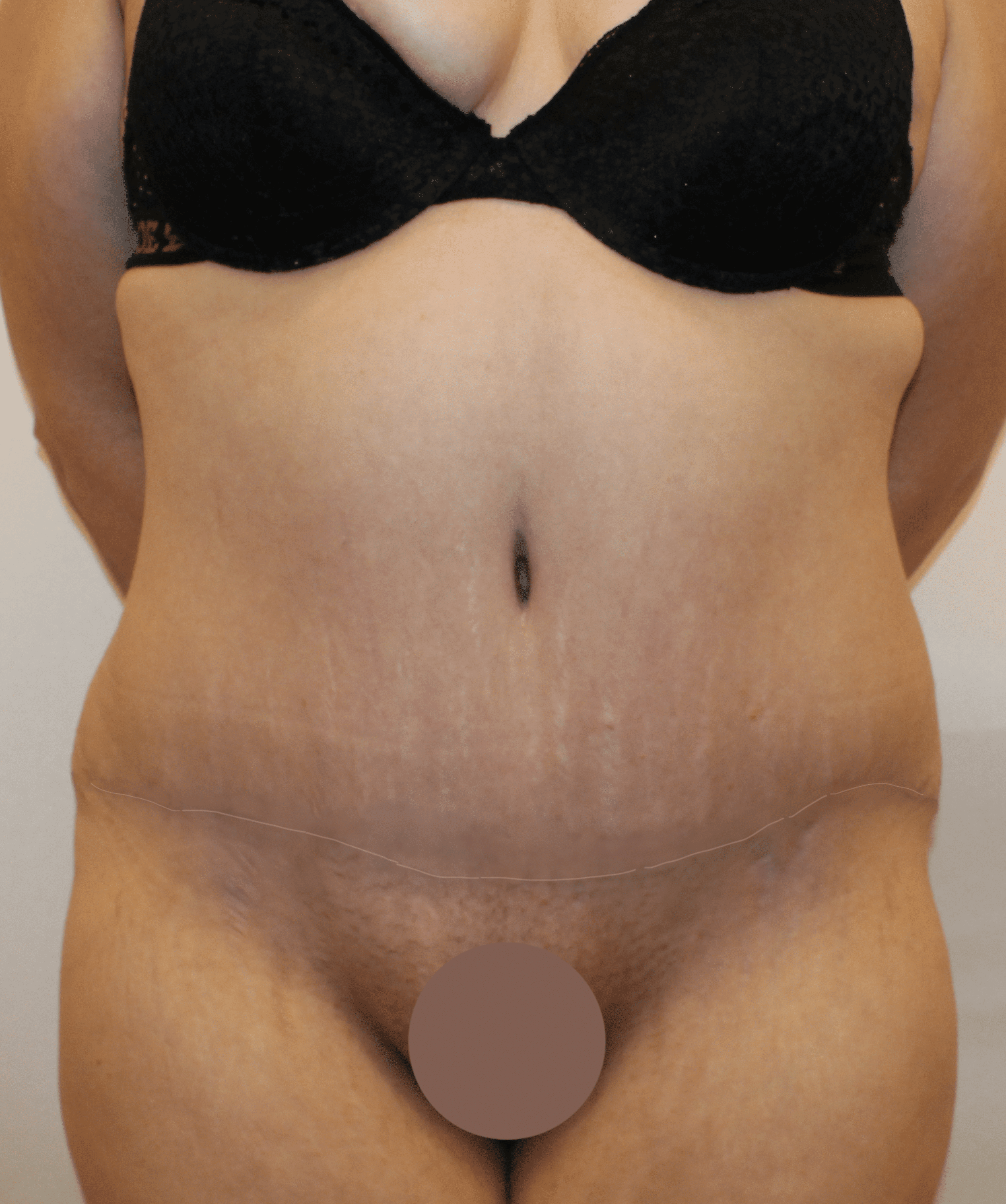 After Image:  - front