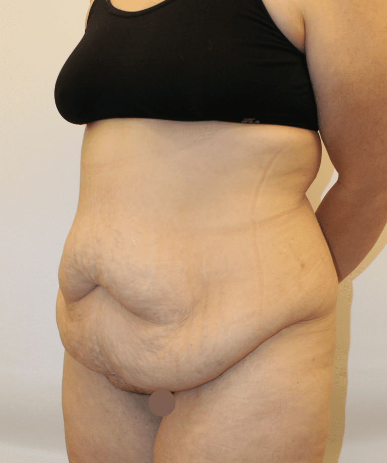 Before Image:  - left-front-oblique