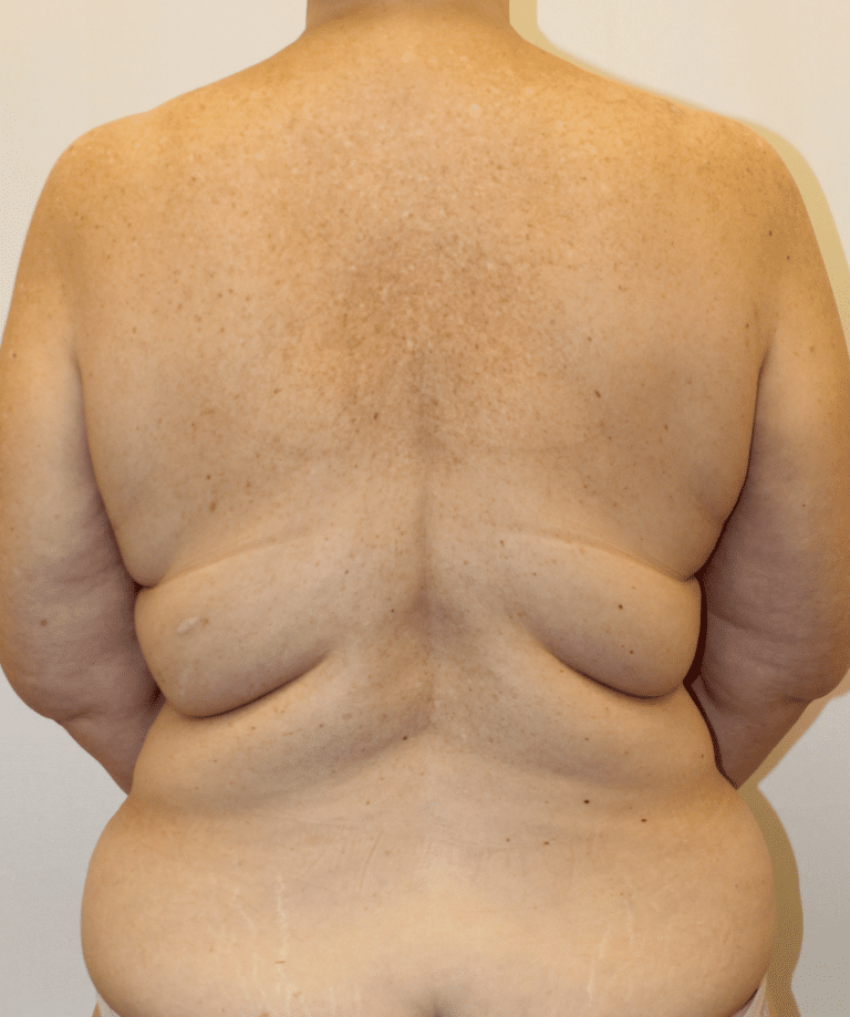 Before Image:  - front