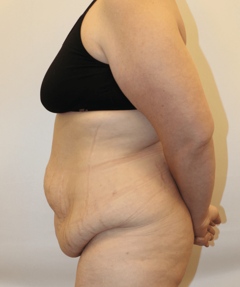 Before Image:  - left-side