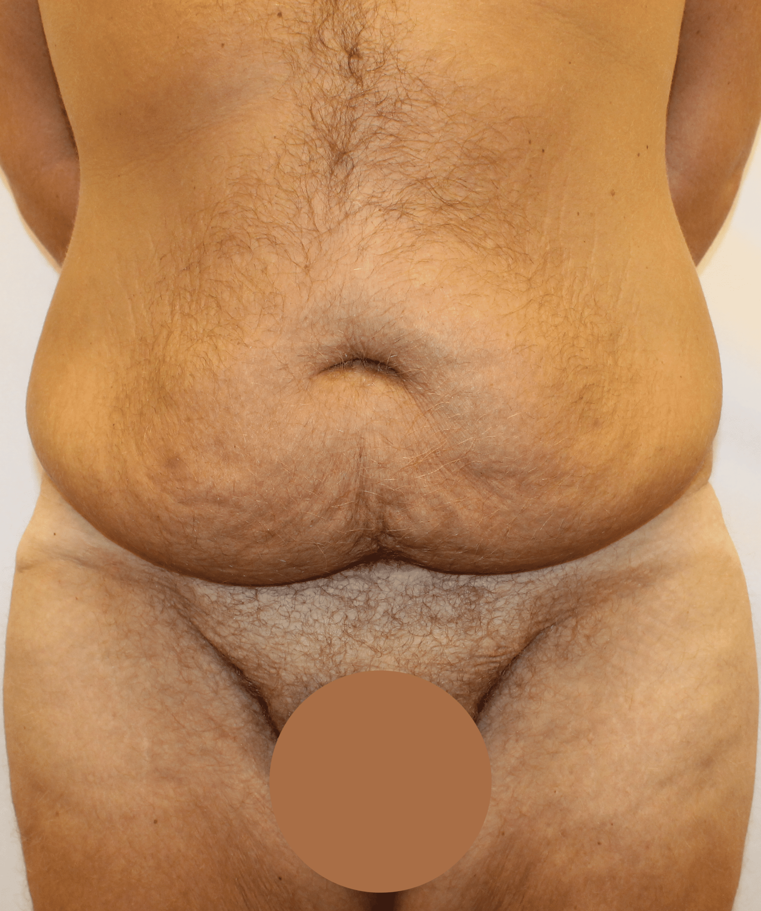 Before Image:  - front