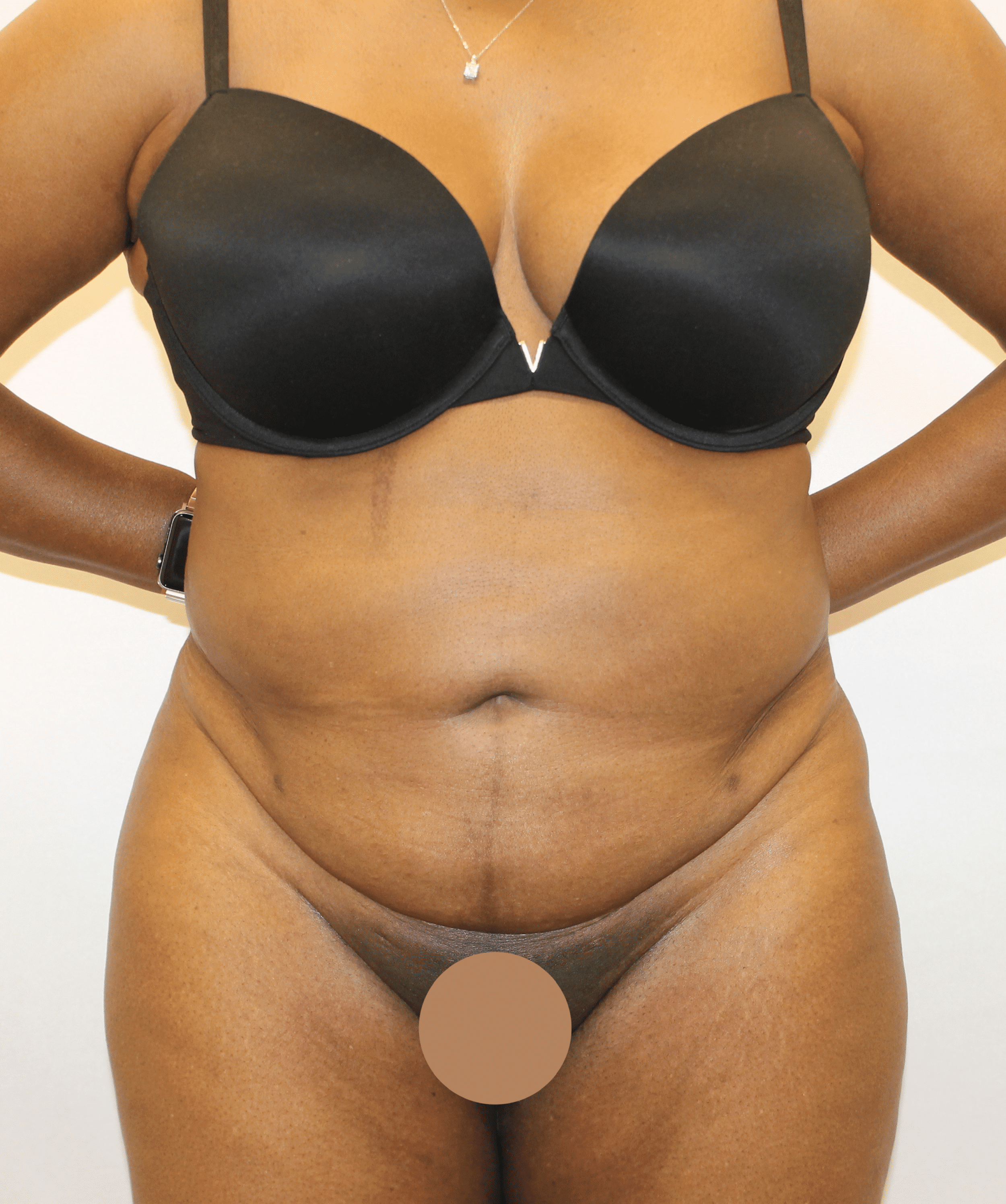 Before Image:  - front