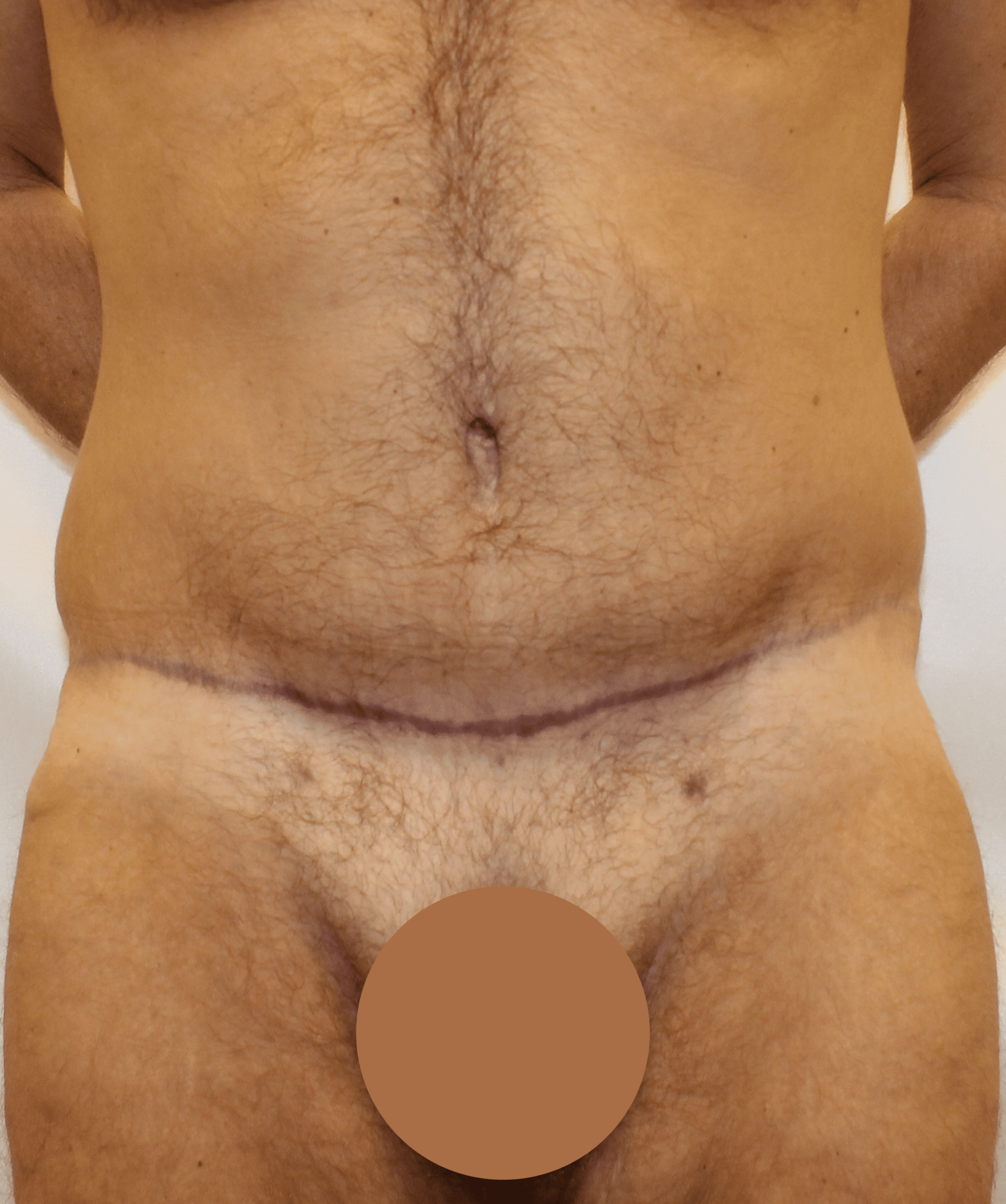 After Image:  - front