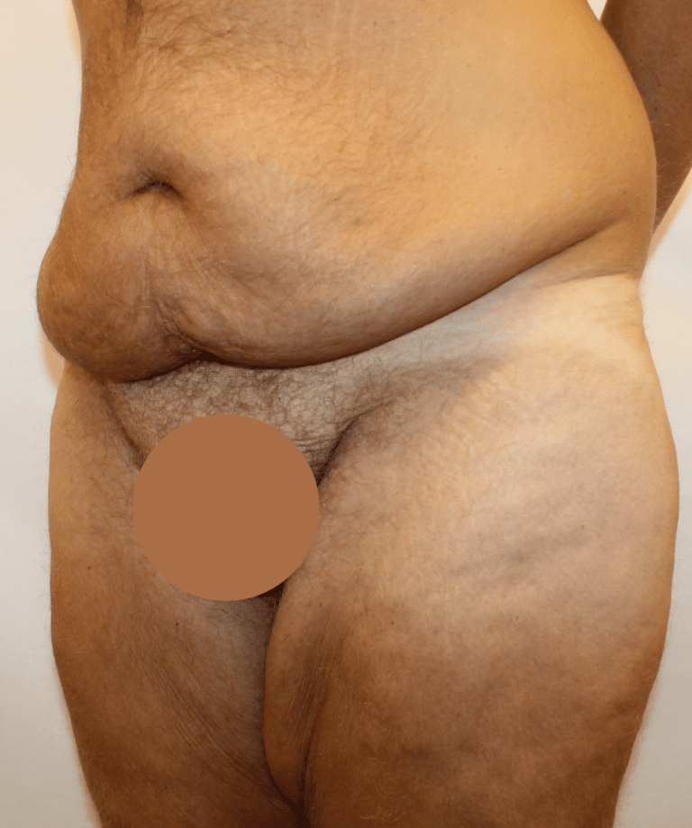 Before Image:  - left-front-oblique