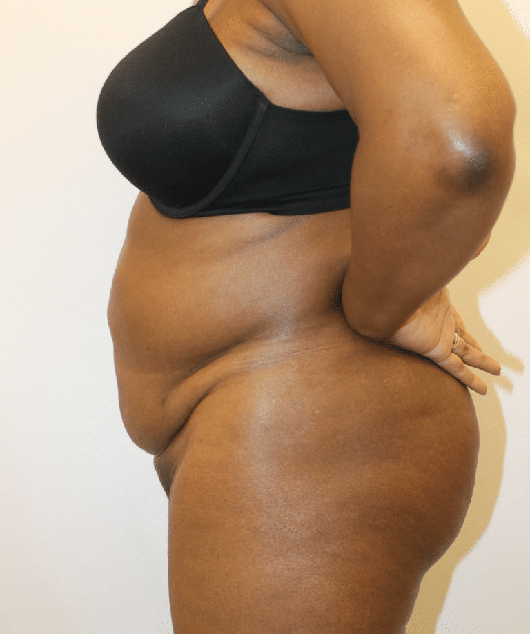 Before Image:  - left-side