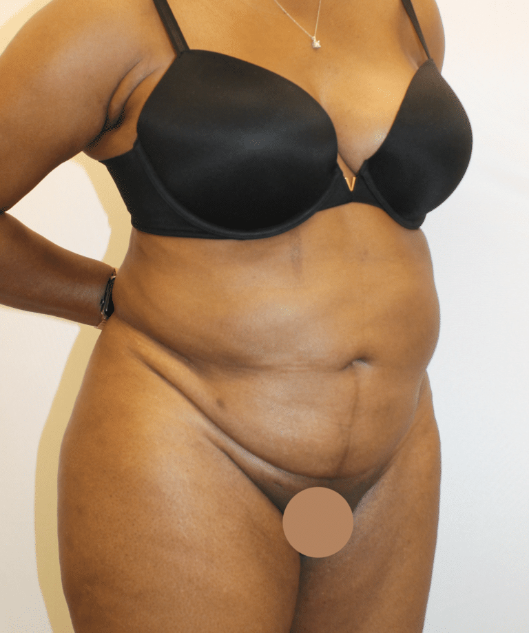 Before Image:  - right-front-oblique