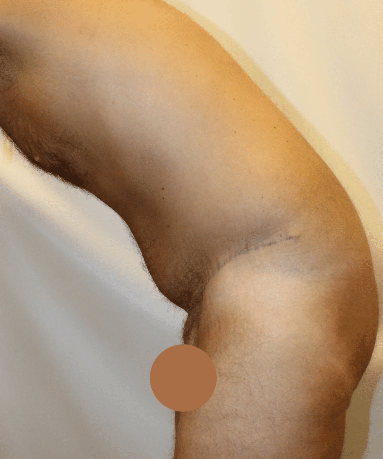 After Image:  - other