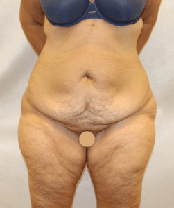 Before Image: