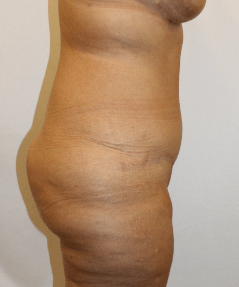 After Image:  - right-side