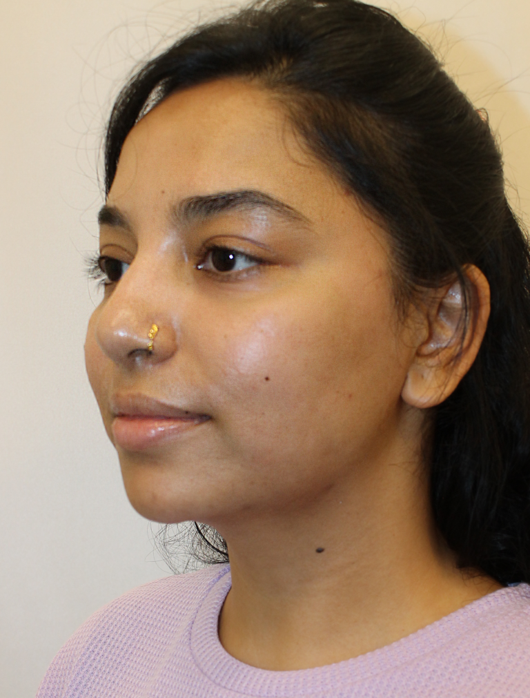 Before Image:  - left-front-oblique