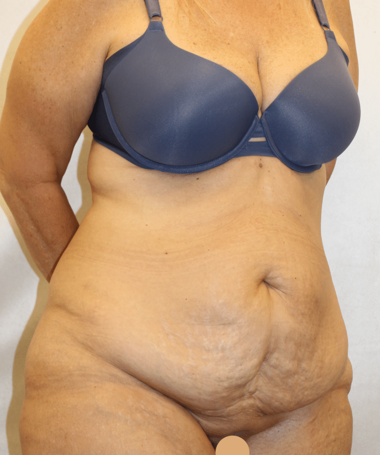 Before Image:  - right-front-oblique