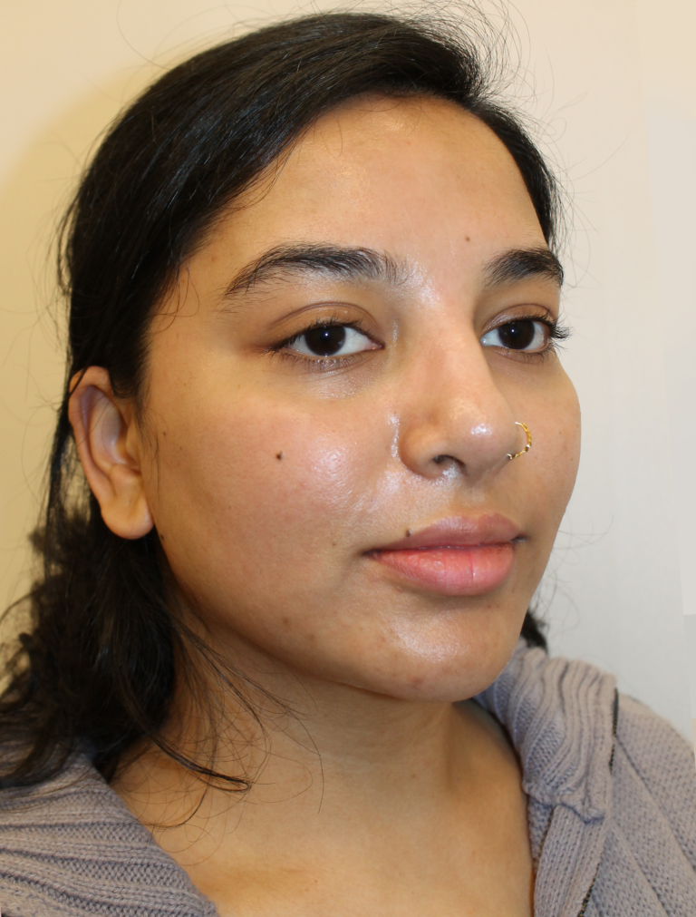 After Image:  - right-front-oblique