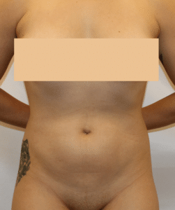 Before Image: