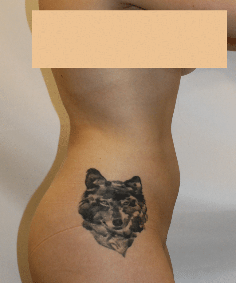 Before Image:  - right-side