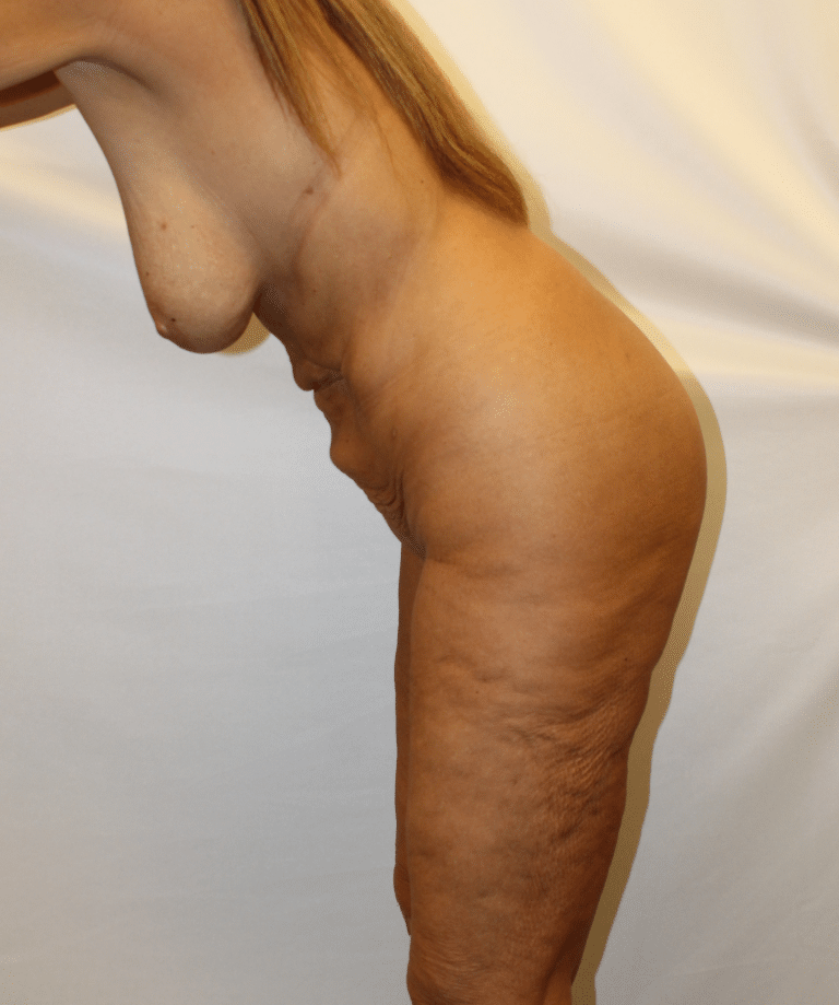 Before Image:  - other
