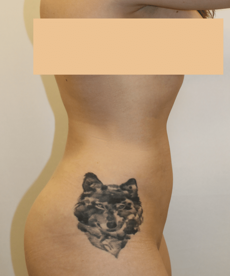 After Image:  - right-side