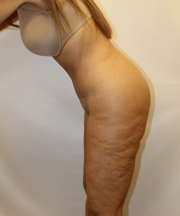 After Image:  - other