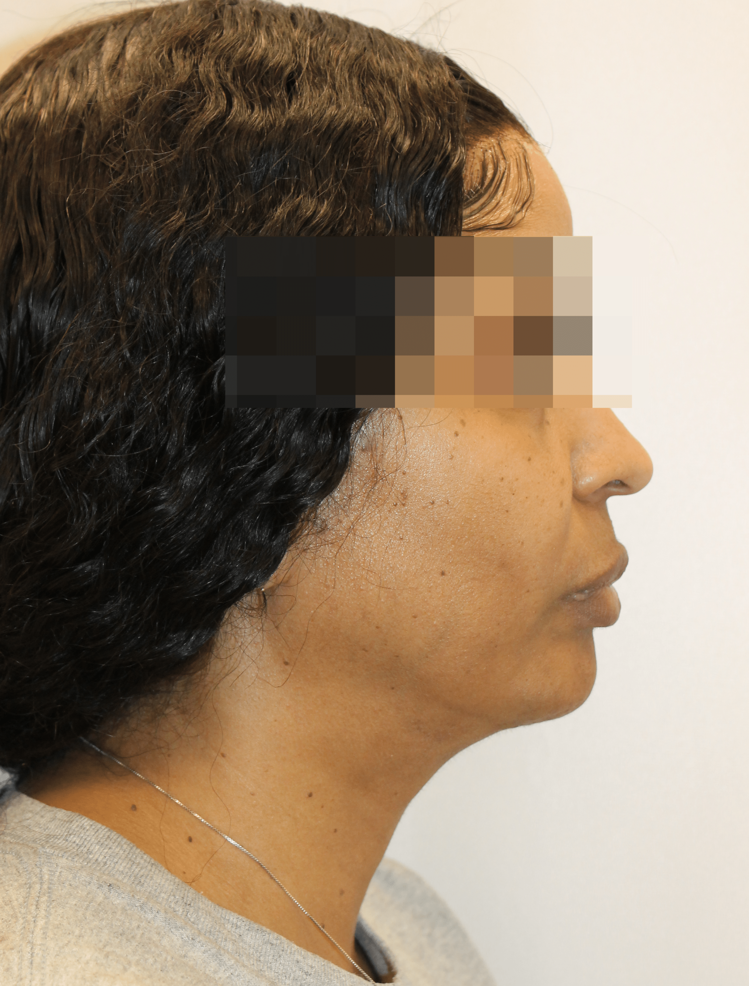 After Image:  - right-side