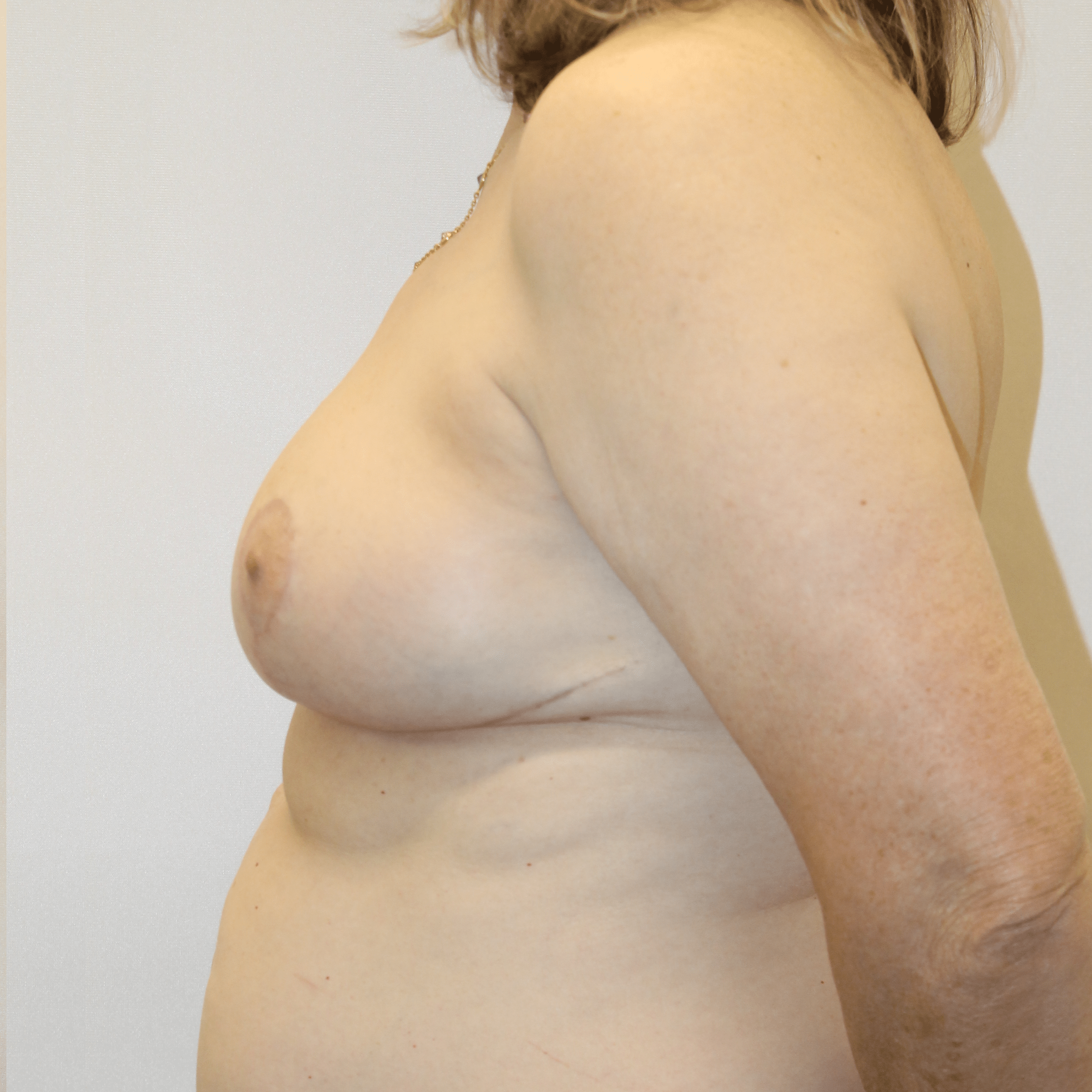 After Image:  - left-side