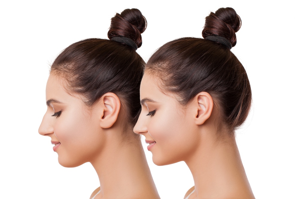 shutterstock 1060368965 (1)