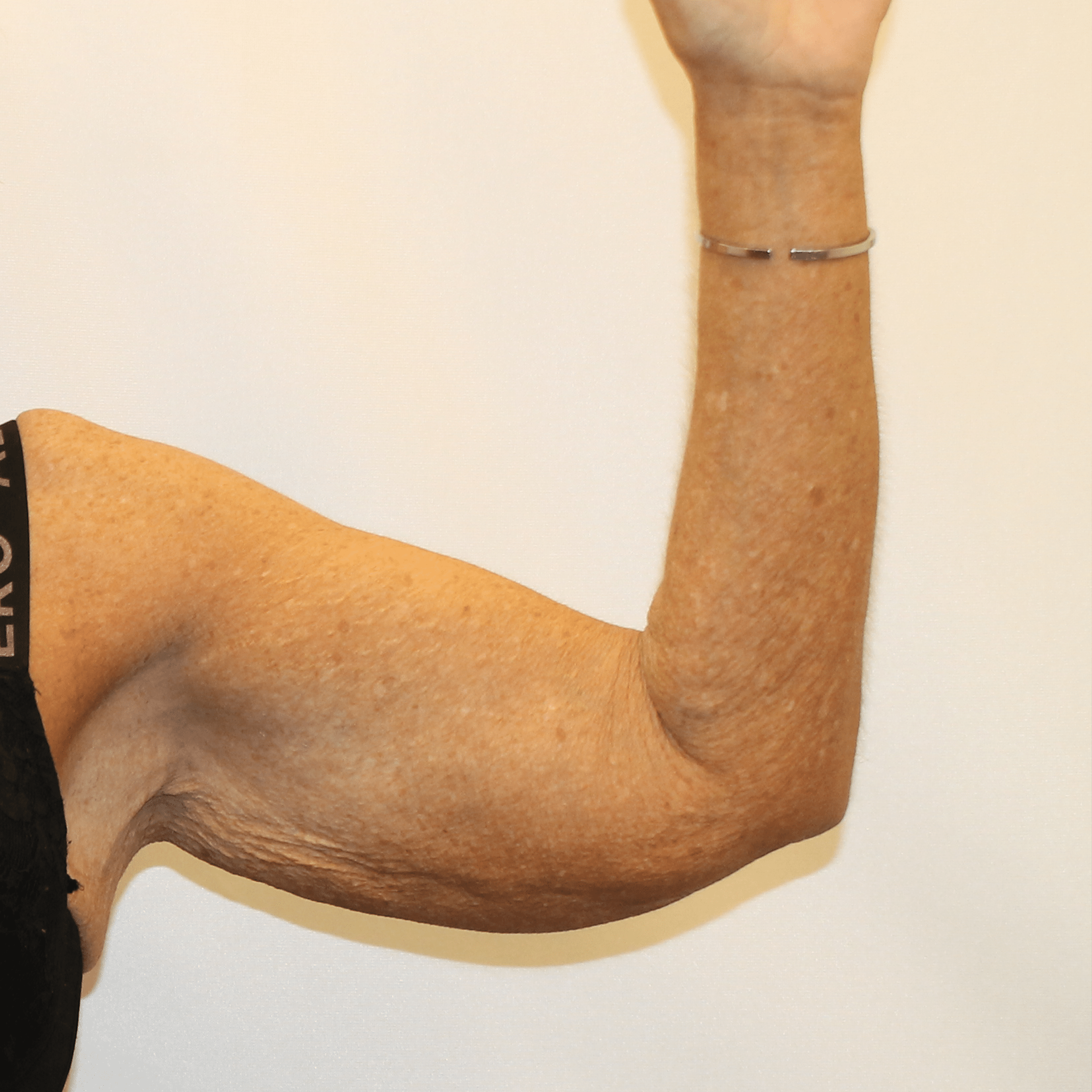 Before Image:  - front