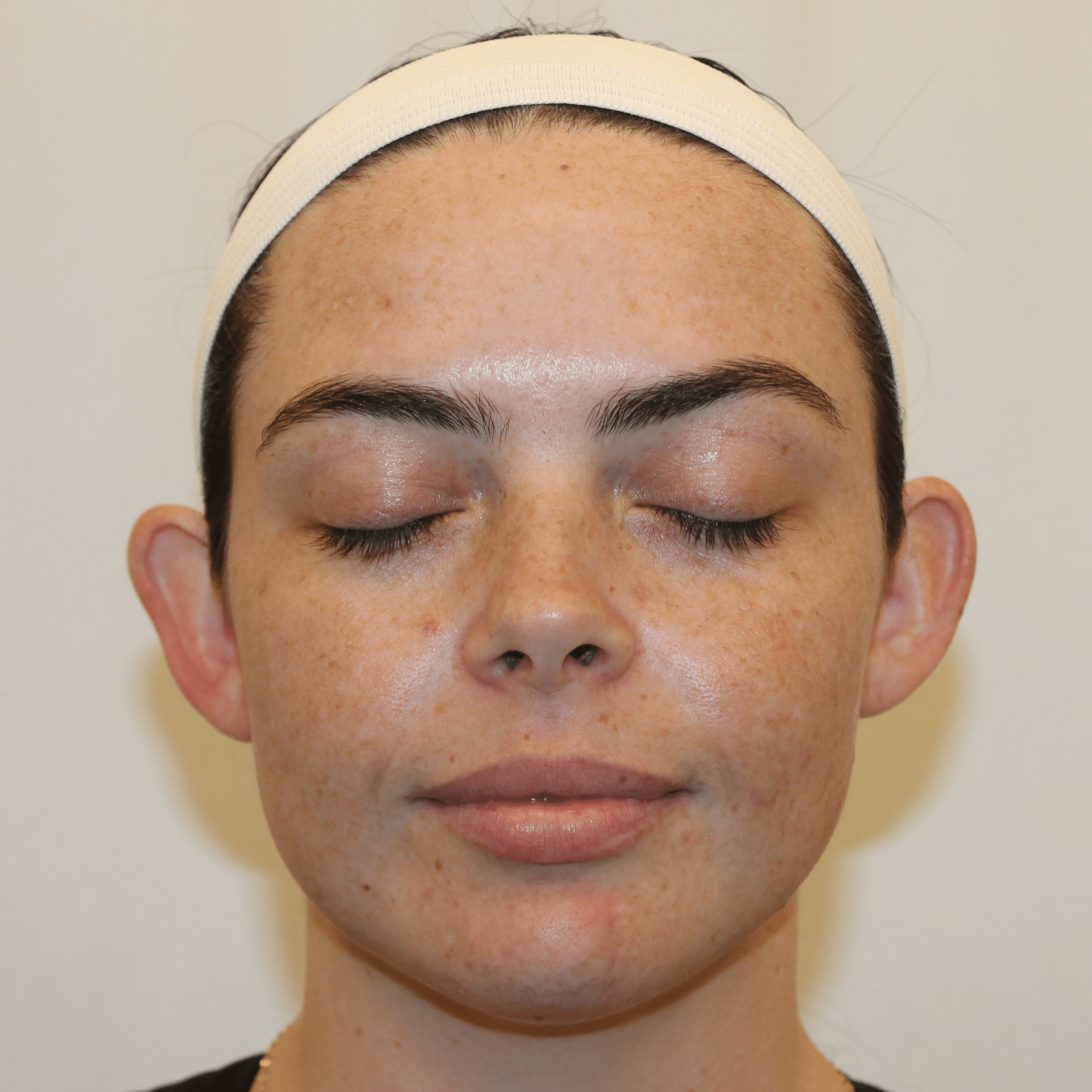 Before Image:  - front