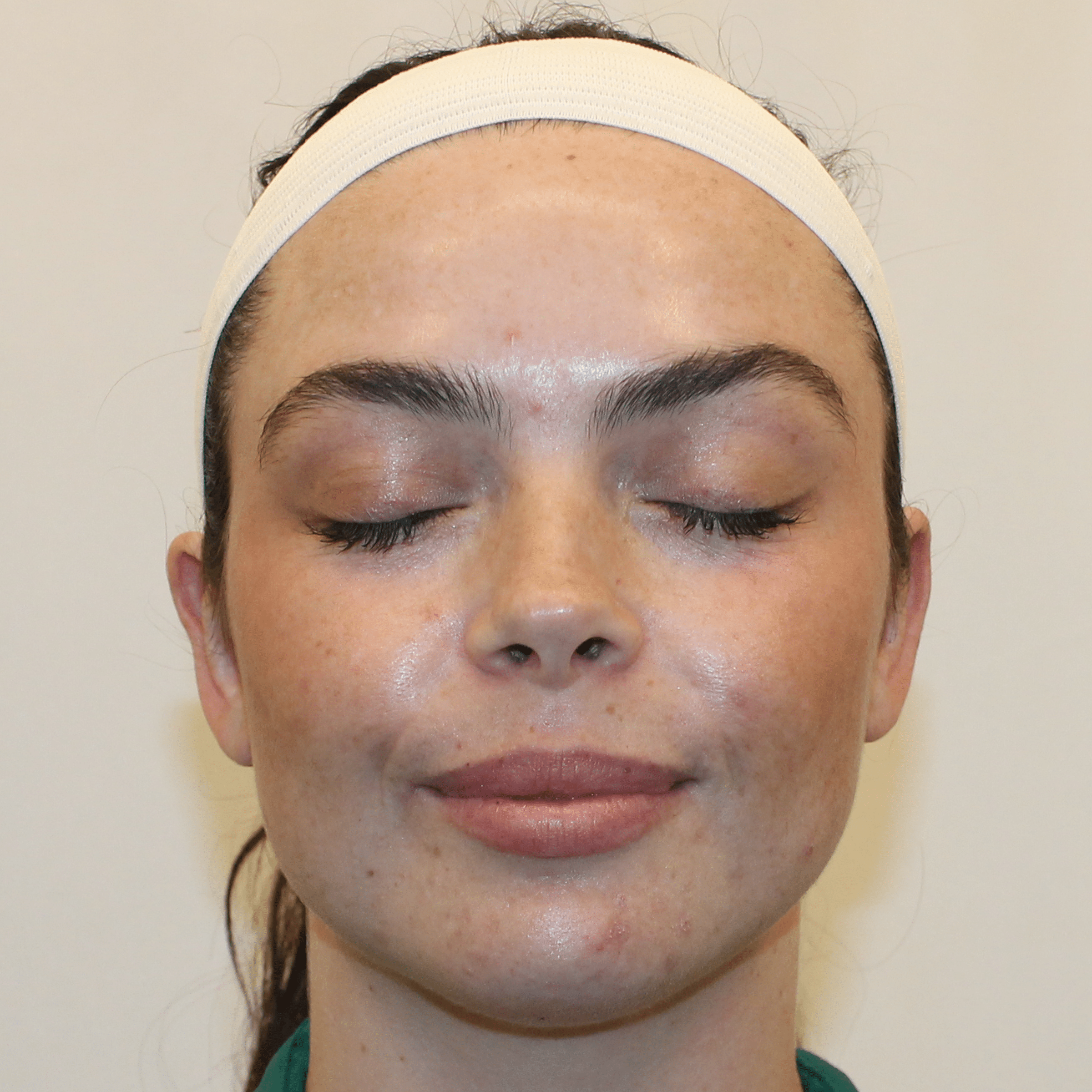 After Image:  - front