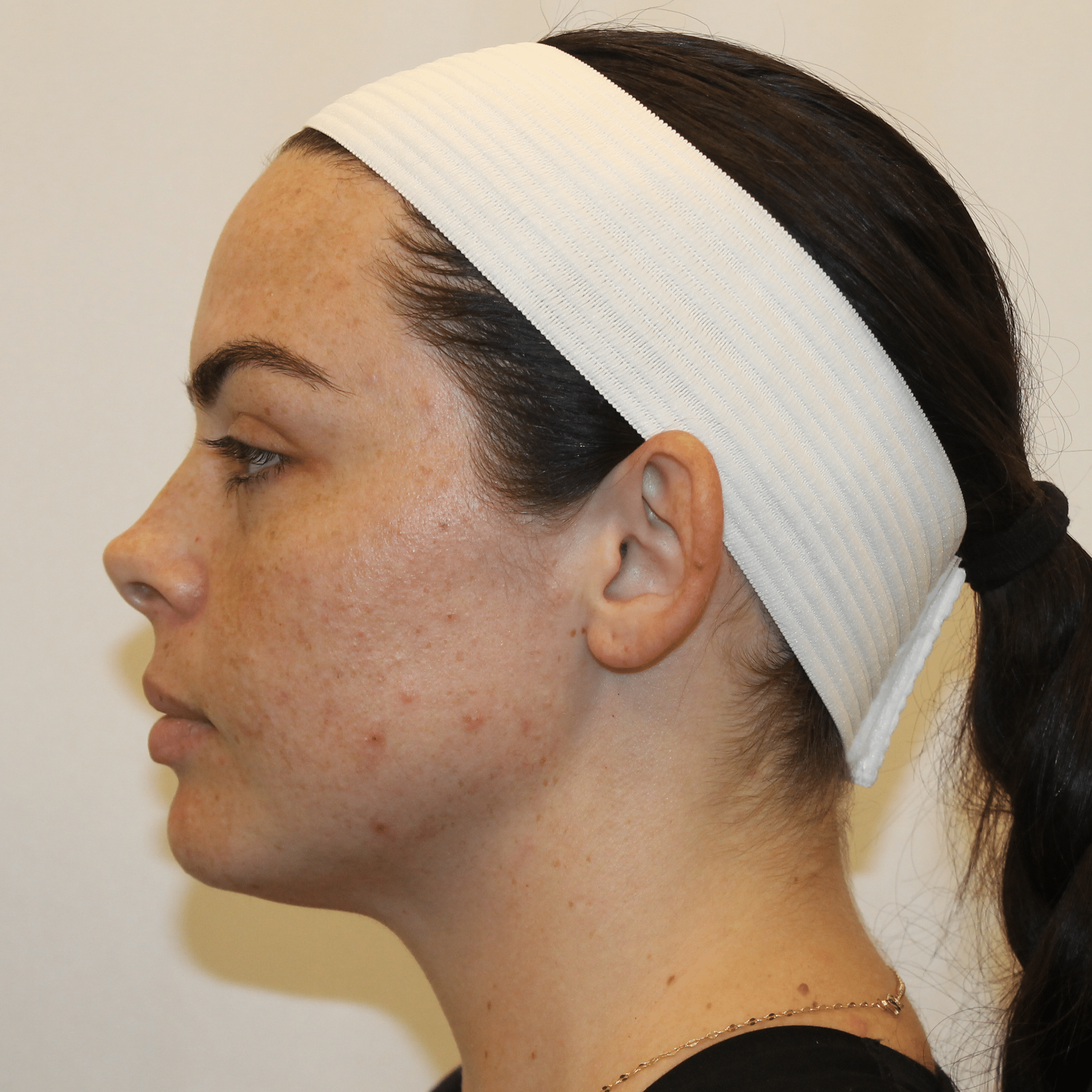 Before Image:  - left-side