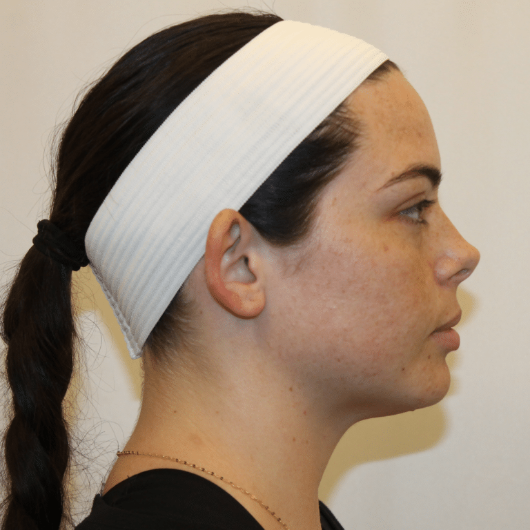 Before Image:  - right-side