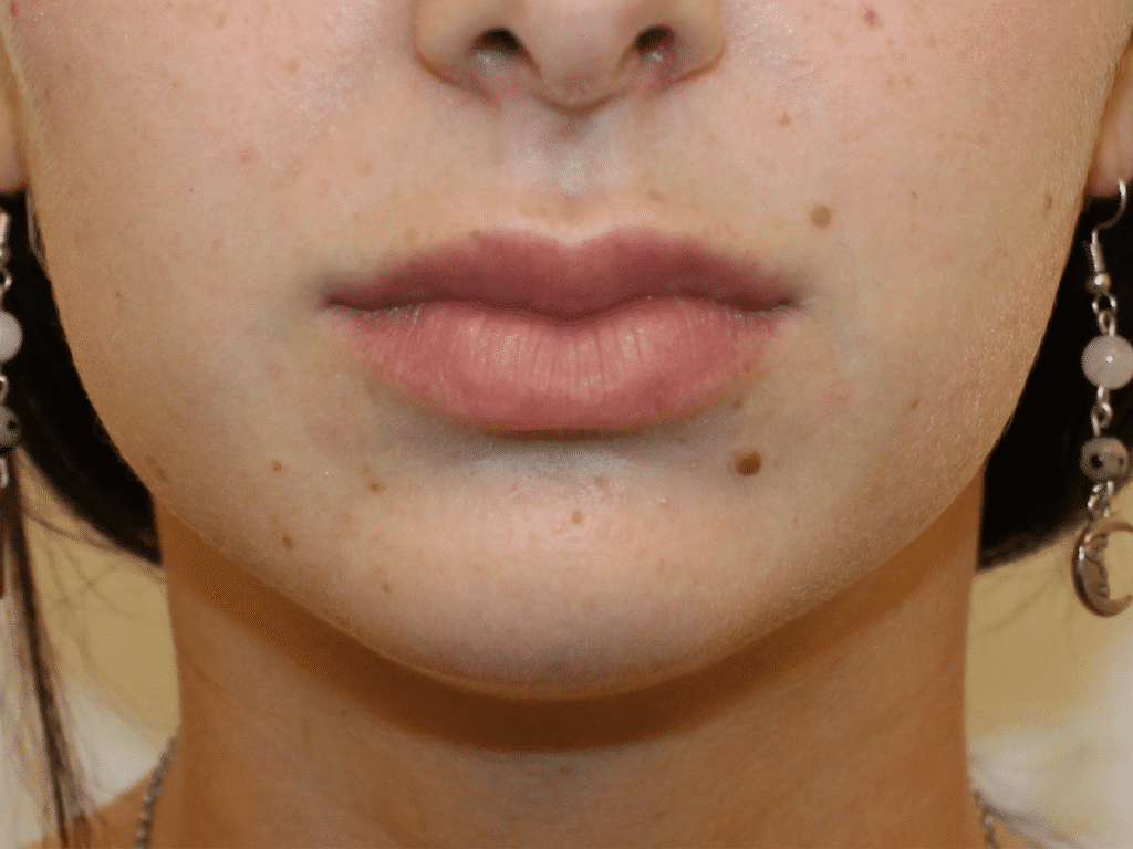 1766078306_1-7 Botox Injections in Gainesville, FL
