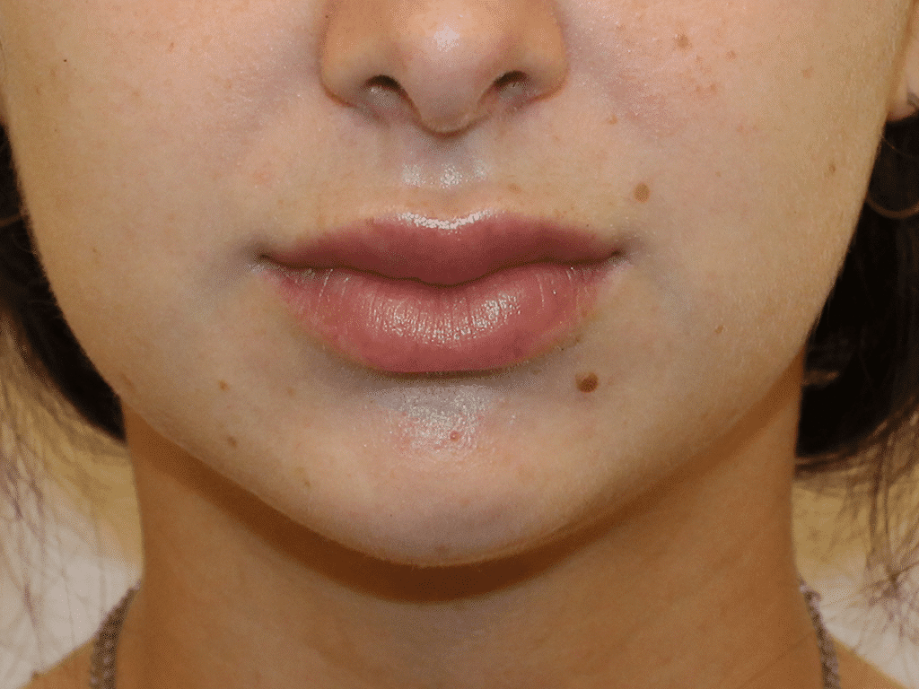 1766078316_2-7 Botox Injections in Gainesville, FL
