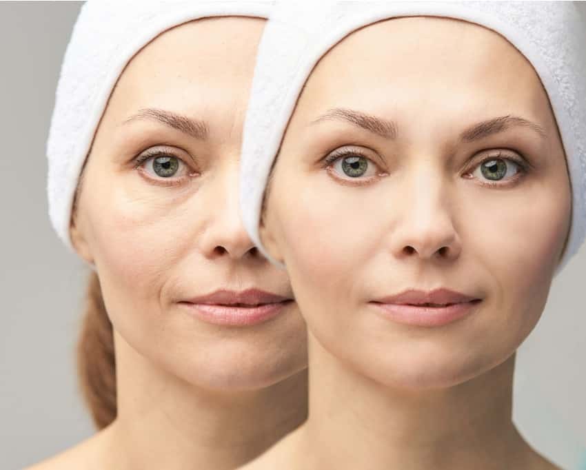 1766078447_pretty-mature-girl-before-and-after-portrait-anti-wrincle-healthy-picture-id1208839969 Facial Rejuvenation in Gainesville, FL