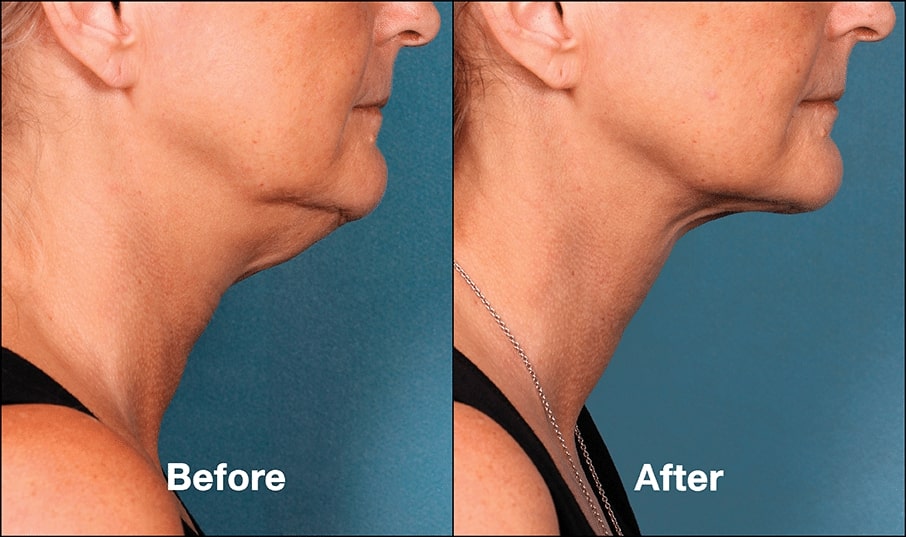 1766078479_original-1450707545 Non-Surgical Cosmetic Treatments in Gainesville, FL