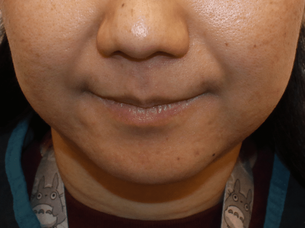 1766079463_1-15 Botox Injections in Gainesville, FL