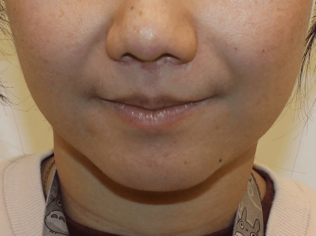 1766079468_2-15 Botox Injections in Gainesville, FL