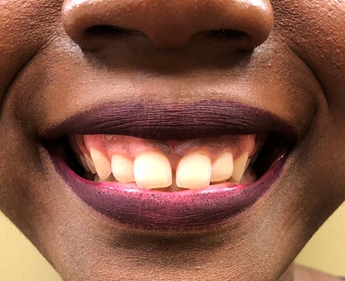 1766080496_1874-67259 Botox Injections in Gainesville, FL