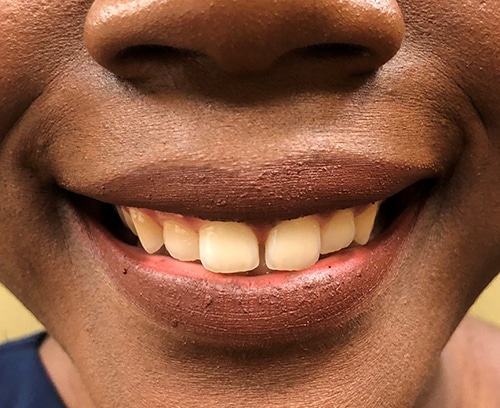 1766080499_1874-92359 Botox Injections in Gainesville, FL