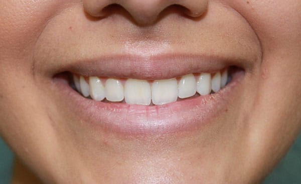 1766080509_1820-47276 Botox Injections in Gainesville, FL